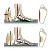Arch Support Bundle | Get-akusoli.com