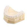 Guard For Teeth Clenching | Jsdentallab.com