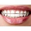 Wire Retainers : Ihome Dental