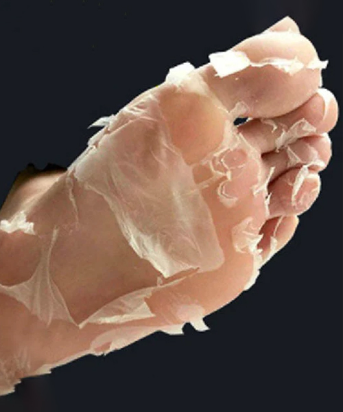 Deep Exfoliation Foot Peel